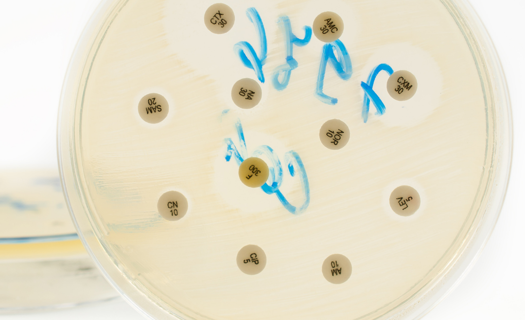 Antybiogram i badanie mikrobiologiczne